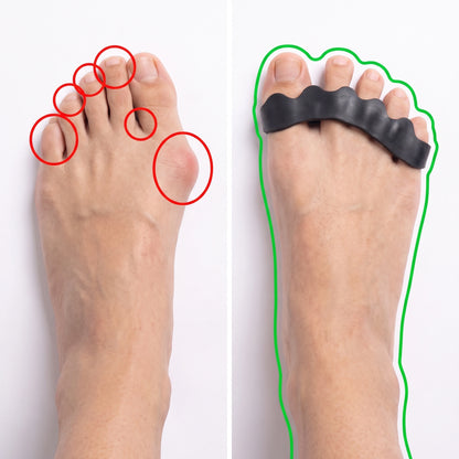 Toe Separator