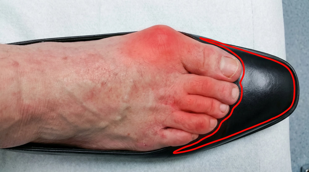 You've been walking in casts your whole life
